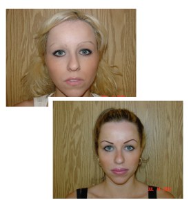 Eyebrow enhancements